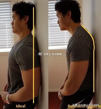 筋膜球相关图片4