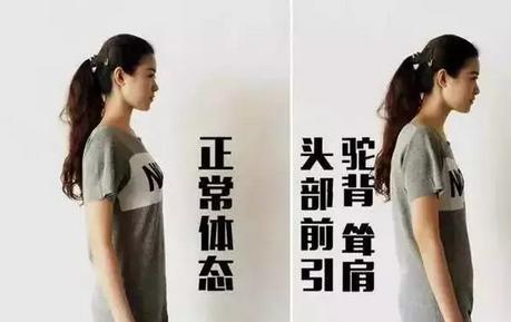 支撑送肩相关图片1