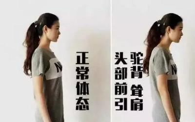 有哪些能改善后天圆肩驼背的健身动作？这5个每天练就行