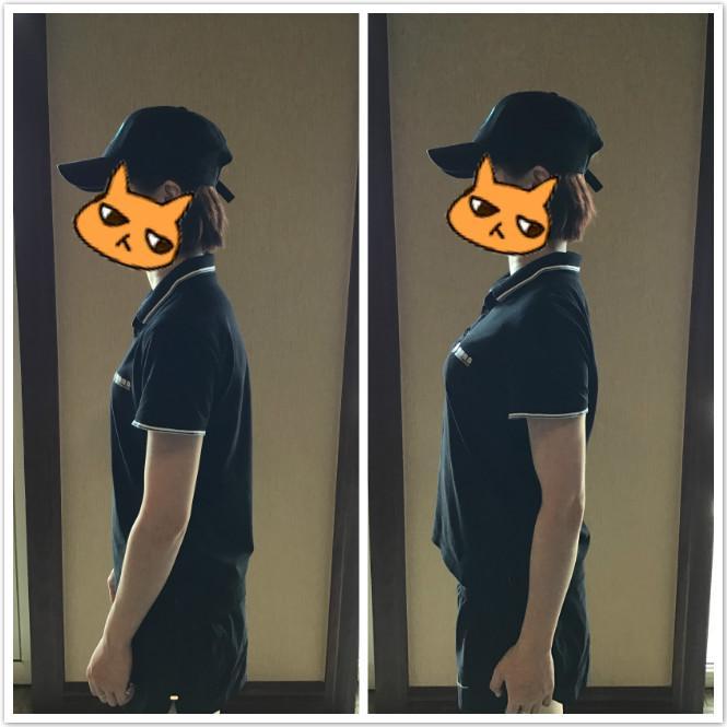 斜方肌相关图片11