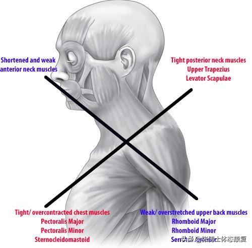 胸大肌相关图片3