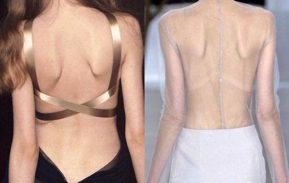 弹力带相关图片7