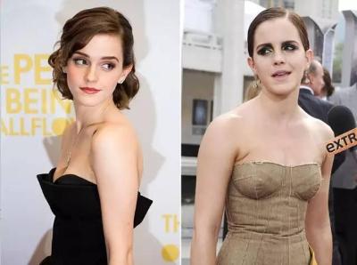 女孩想要改善驼背该做哪些健身动作